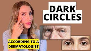 Can You Get Rid of Dark Circles Under Your Eyes? Dermatologist Explains | Dr. Sam Ellis