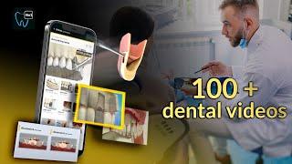 Dental videos and animations for dentists|patient education|DentiCalc