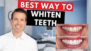 Why Your Teeth are Yellow | How to fix Stained teeth