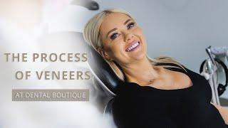 The Process of Veneers - Dental Boutique