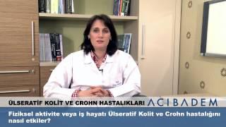 Fiziksel aktivite veya iş hayatı Ülseratif Kolit ve Crohn hastalığını nasıl etkiler?