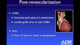 Appropriate Indications for Cardiac CT