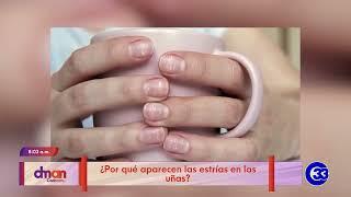 #DeMujerAMujer | ¿Por qué aparecen las estrías en las uñas?