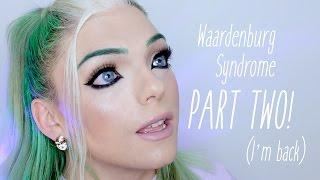 My Face: Waardenburg Syndrome (Part Two) | Stef Sanjati