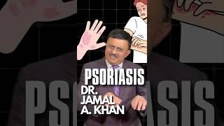 Expert Insights on Psoriasis Management | Dr Jamal A Khan