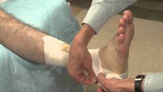 Ankle Wrapping Technique - Mayo Clinic