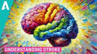 Understanding Stroke