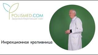 Инфекционная крапивница: причины, признаки, диагностика, лечение, последствия, профилактика