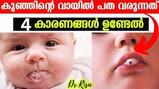 Baby Care Tips Malayalam| Foamy Saliva in Babies | കുഞ്ഞിന്റെ വായിൽ പത വരുന്നത്