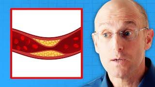 Cardiologist’s TRUTH About Saturated Fat and Clogged Arteries | Dr. Bret Scher