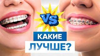 Керамические брекеты VS Металлические брекеты — что лучше?