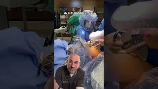 Is Orthopedics the messiest surgical subspecialty? #shorts