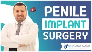 Penile Implants Surgery - Dr. Yaşar Başağa, MD, FEBU