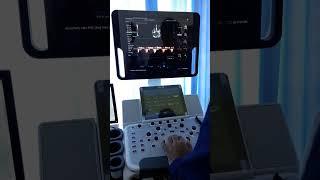 Mindray DC-40 Ultrasound System Cardiac Demonstration