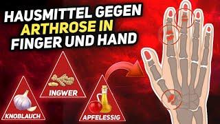 7 Natürliche Hausmittel gegen Arthrose in Finger und Hand