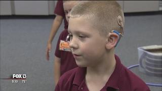 Years later, child's cochlear implants are his 'ears'