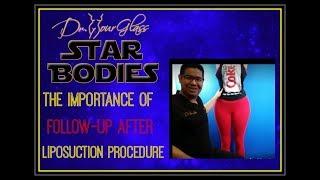 First week after liposuction | Houston | Dallas | San Antonio | Austin