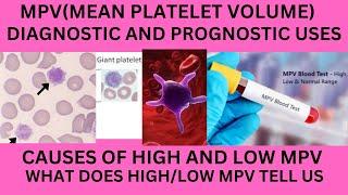 MEAN PLATELET VOLUME(MPV).NORMAL RANGE.CAUSES OF HIGH MPV,LOW MPV,MPV AND THROMBOCYTOPENIA,MPV USES