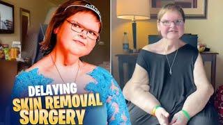 Breaking News !! 1000-Lb Sisters: Tammy's Skin Removal Surgery Drama Unpacked.