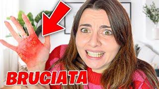 DANI si è BRUCIATA LA MANO e STA MALE…!?