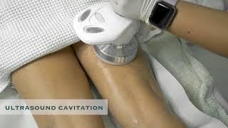 Ultrasound Cavitation at Euromed Clinic Dubai