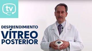 Desprendimiento del vítreo posterior