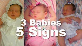 Signs of Autism in Babies Under 1| 3 Sisters| 5 Signs