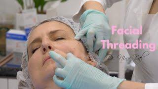 Facial Threads Lift Before and After | Thread Lift Face  Dr. Nina Bal  Facial Sculpting