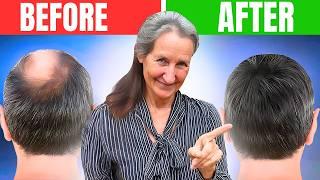 Barbara O'Neill's SHOCKING Hair Loss Discovery: What They Hid From You!