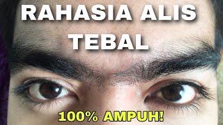 CARA MENEBALKAN DAN MENUMBUHKAN ALIS MATA DENGAN MINOXIDIL || 100% AMPUH