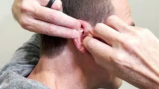 How to insert and remove behind-the-ear (BTE) hearing aids