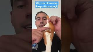 Why your knee cap keeps dislocating #shorts #kneecap