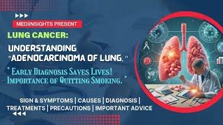 Understanding Adenocarcinoma of Lung: Symptoms, Causes, Diagnosis, and Treatments | MediInsights