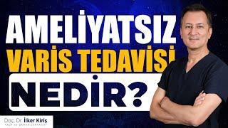 AMELİYATSIZ VARİS TEDAVİSİ NE DEMEKTİR?