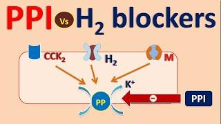 Proton pump inhibitors (PPI) vs H2 blockers