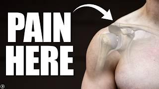 Acromioclavicular (AC) Joint Sprain | Separated Shoulder Rehab (Education & Exercises)