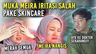 MUKA MEIRA IRITASI KARENA SALAH SKINCARE! KE DOKTER SEKARANG JUGA!