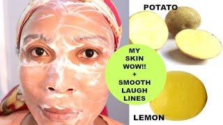 I USE POTATO AND LEMON ON MY SKIN, LOOK WHAT IT DID TO MY SKIN!! CLEAR DARK SPOTS + REMOVE WRINKLES