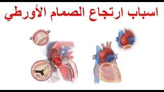 ما هي اسباب ارتجاع الصمام الأورطي ؟ ما هو تأثير ارتجاع الصمام الابهري على القلب و ما هي المضاعفات  ؟