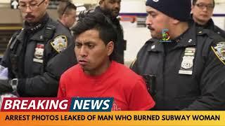 BREAKING NEWS: ARREST PHOTOS RELEASED OF MAN WHO BURNED WOMAN ON NYC SUBWAY