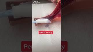 #period#periods_#periodpoverty_#poverty#tampon_#pad_#tampons #short