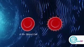 Hemolytic disease of the newborn(HDN)