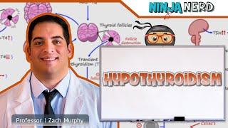 Hypothyroidism | Clinical Medicine