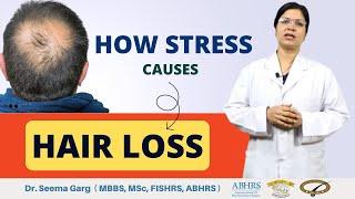 How Hair Loss Happens in Stress? | Stress can cause hair loss | Dr. Seema Garg