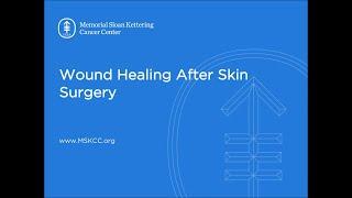 Wound Healing After Skin Surgery | Memorial Sloan Kettering