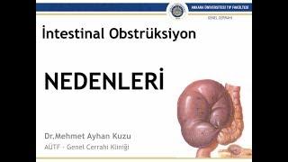 İntestinal Obstrüksiyon: (4/9) Nedenleri