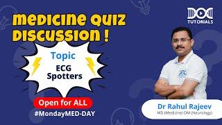 #mondaymedday | Medicine Quiz Discussion by Dr Rahul Rajeev | ECG Spotters | DocTutorials