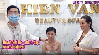 Cystic acne treatment I Điều trị mụn nang hiệu quả số 1 Hiền Vân Spa I Huỳnh Việt Hồ I Part 3 I 501