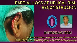 Reconstruction of Partial Loss of Helical Rim: Restoring Ear Aesthetics with Dr. M. Bhanu Murthy