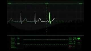 heart beat monitor animation free stock footage